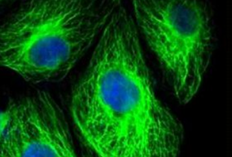 FITC标记海藻糖,荧光素标记海藻糖,FITC-Trehalose FITC标记海藻糖,荧光素标记海藻糖,FITC-Trehalose