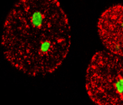 Indocyanine Green Indocyanine Green