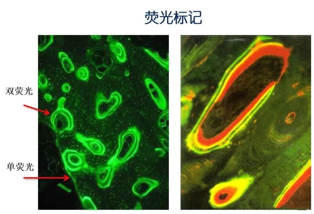 聚糖的技术原理和方法