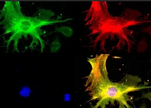 装载无机纳米粒子的脂质体定制合成技术