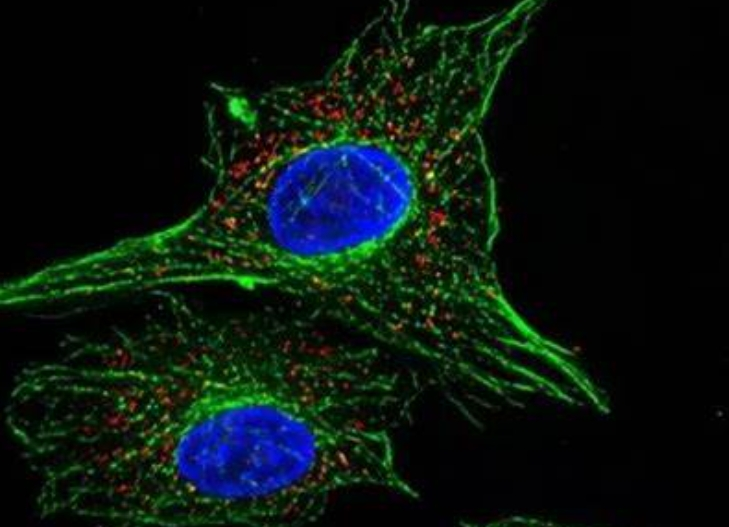 Gd修饰载药脂质体 Gd-Functionalized Drug-Loaded Liposome Customization
