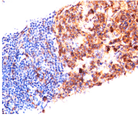 FITC标记CD38(ARGDYYGSNSLDYW) FITC标记CD3FITC标记CD38(ARGDYYGSNSLDYW)8(ARGDYYGSNSLDYW)